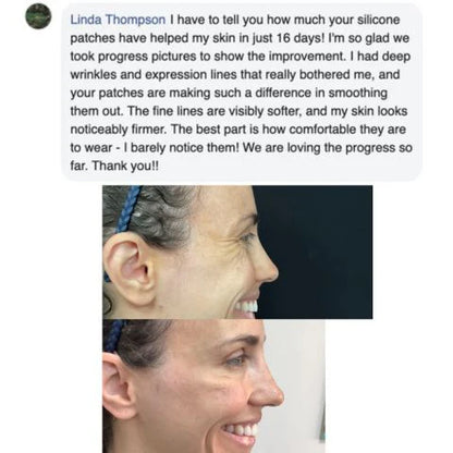 Onesiena™ Silicone Scar & Wrinkle Tape