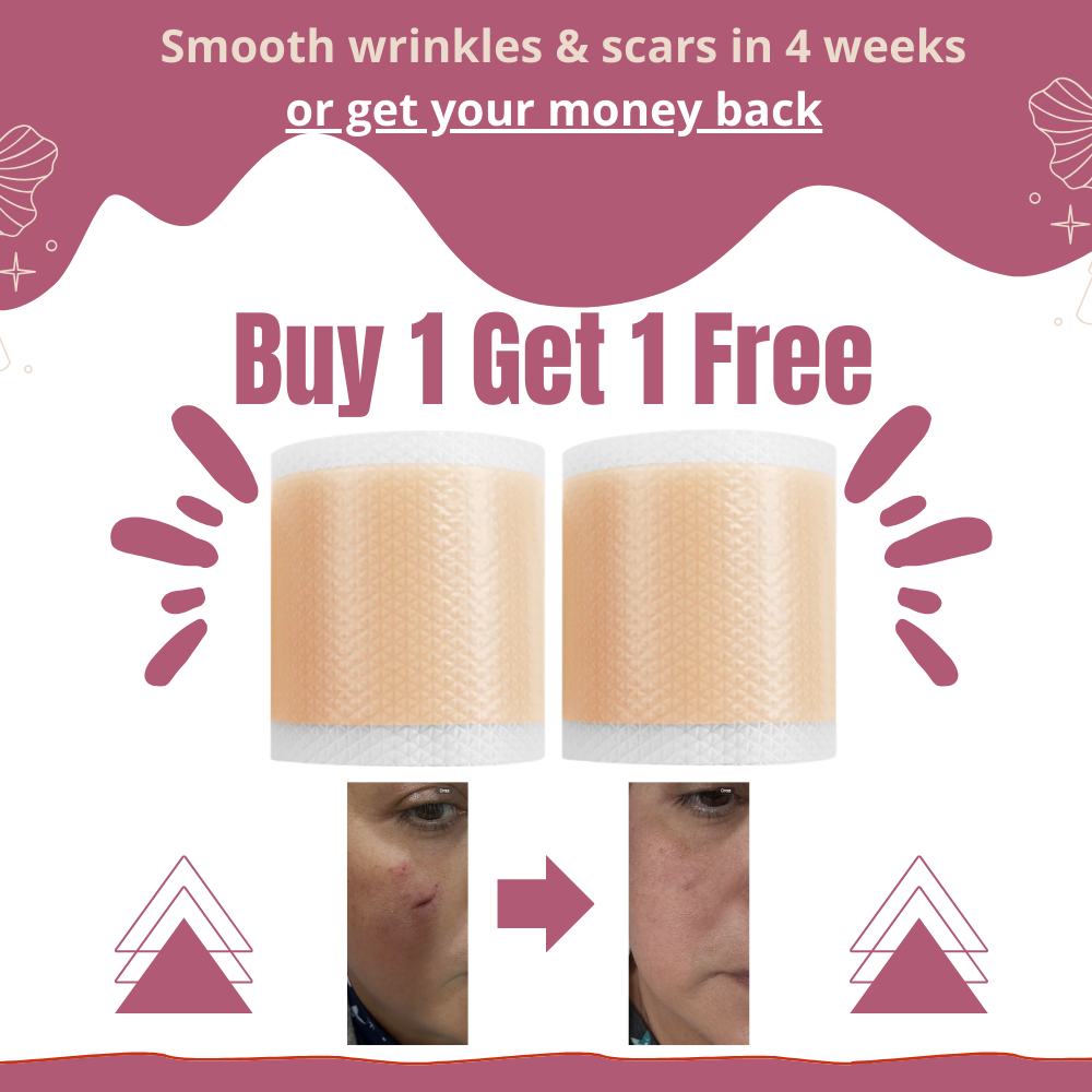 Onesiena™ Silicone Scar & Wrinkle Tape