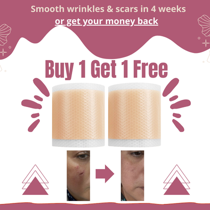 Onesiena™ Silicone Scar & Wrinkle Tape